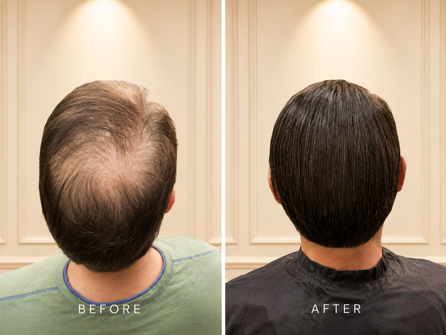 Before and after men's hair restoration for thinning crown in Scottsdale AZ